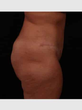 After Image