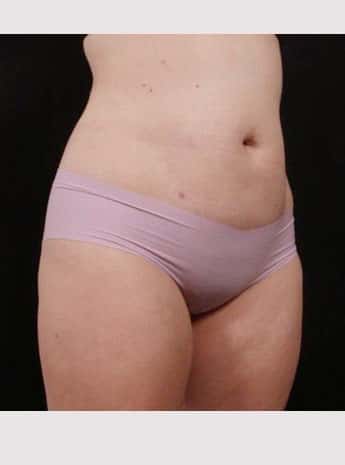 After Image