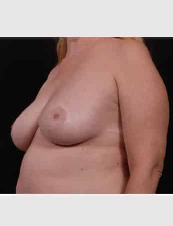 After Image