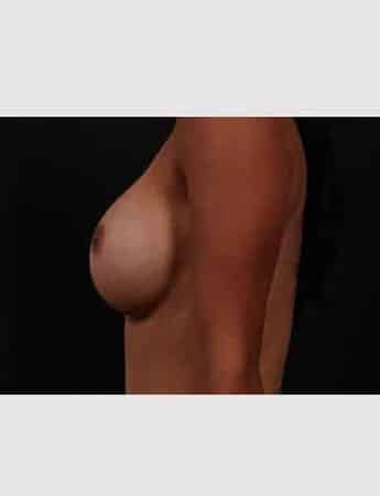 After Image