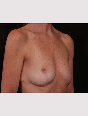 After Image