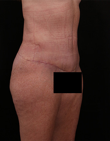 After Image