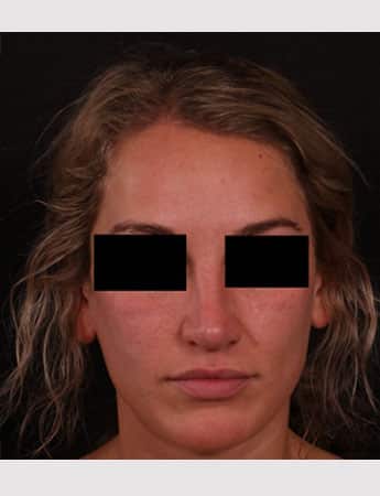 After Image