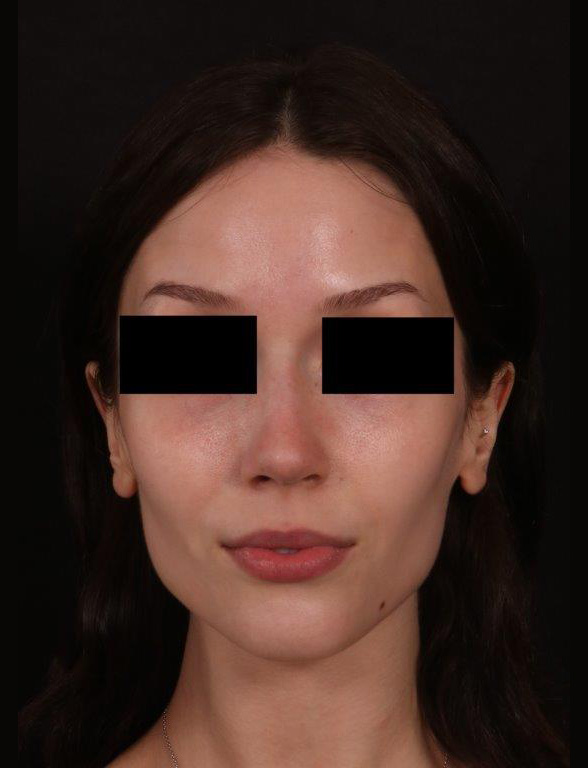 After Image