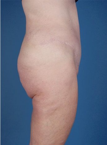After Image