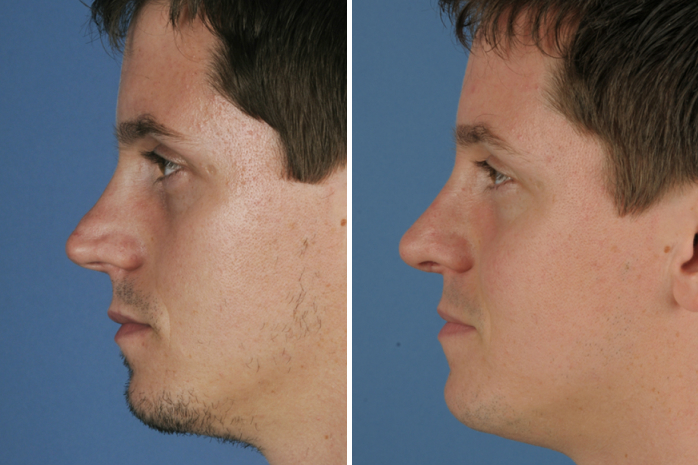 Before Image